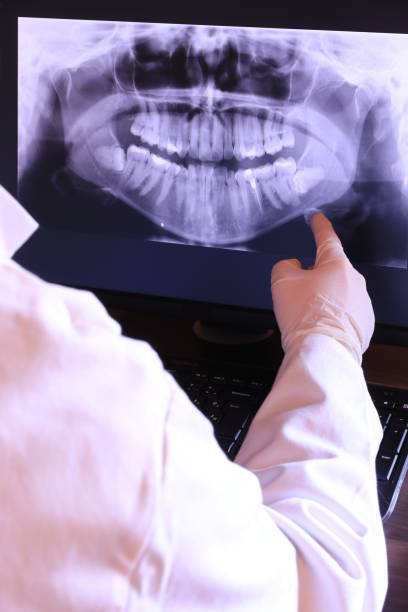 Best Emergency Treatment for Oral Infections in Wills Point, TX